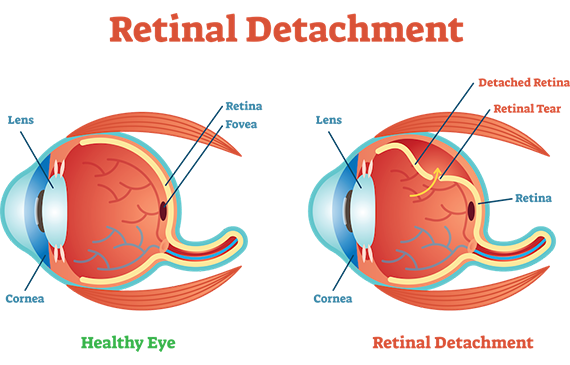 Medical Retina